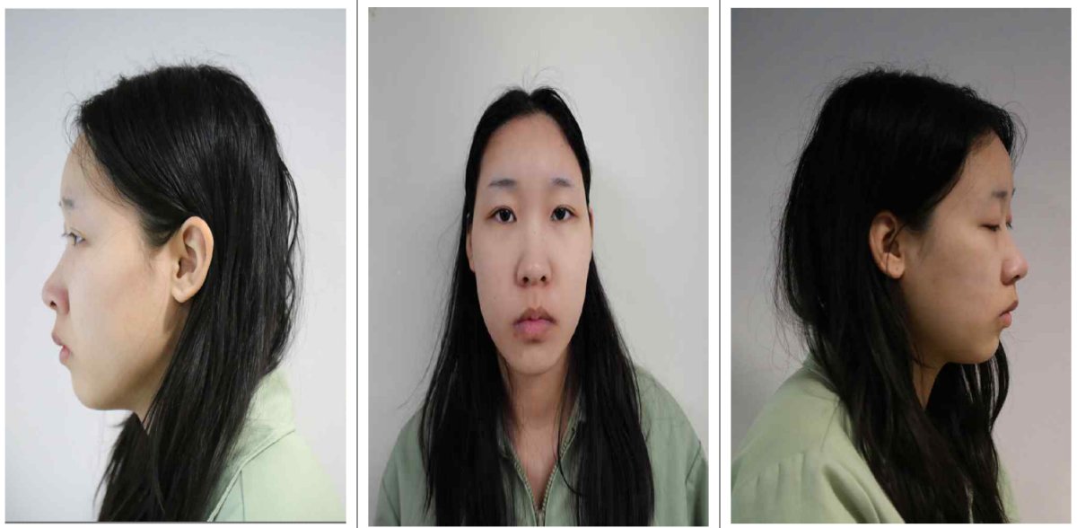 Солонгост дуулиан тарьсан хэргийн сэжигтэн 20 настай эмэгтэйн зургийг олон нийтэд ил болголоо